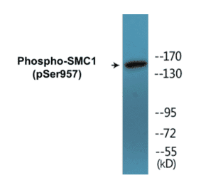 Western Blot - SMC1 (phospho Ser957) Cell Based ELISA Kit (CBP1674) - Antibodies.com