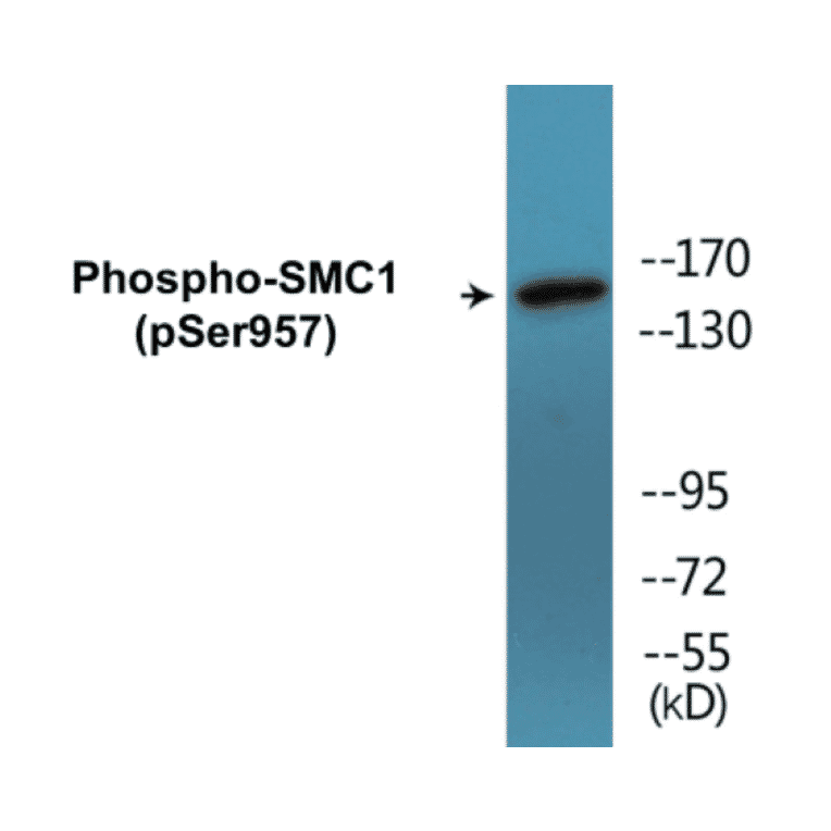Western Blot - SMC1 (phospho Ser957) Cell Based ELISA Kit (CBP1674) - Antibodies.com