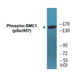 Western Blot - SMC1 (phospho Ser957) Cell Based ELISA Kit (CBP1674) - Antibodies.com