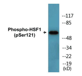 Western Blot - HSF1 (phospho Ser121) Cell Based ELISA Kit (CBP1725) - Antibodies.com