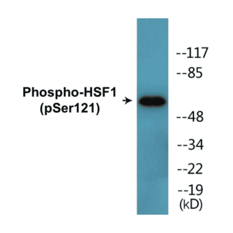 Western Blot - HSF1 (phospho Ser121) Cell Based ELISA Kit (CBP1725) - Antibodies.com