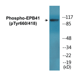 Western Blot - EPB41 (phospho Tyr660 + Tyr418) Cell Based ELISA Kit (CBP1819) - Antibodies.com