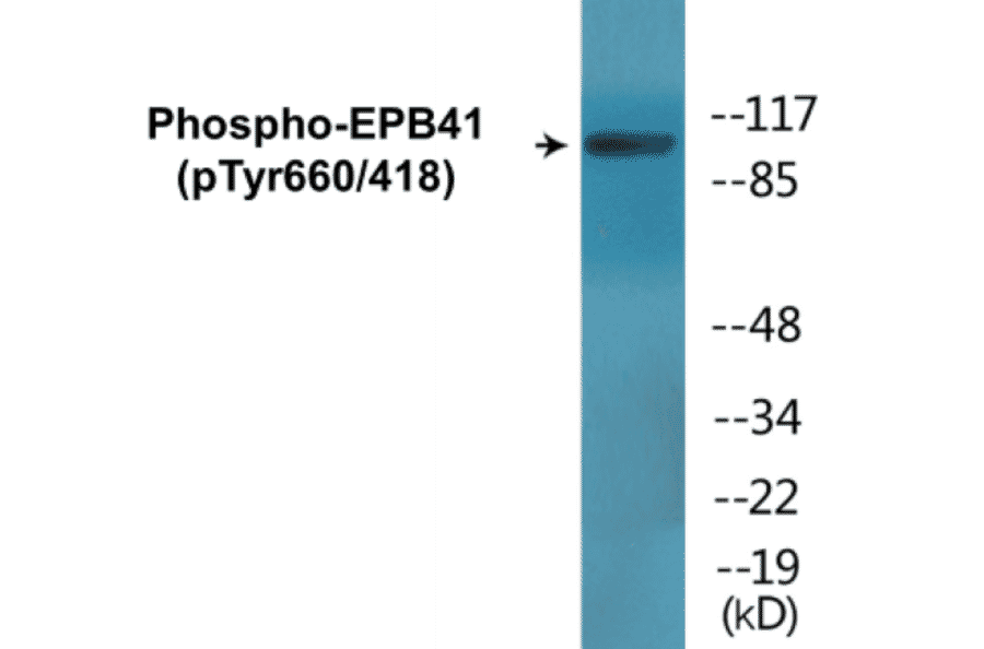 Western Blot - EPB41 (phospho Tyr660 + Tyr418) Cell Based ELISA Kit (CBP1819) - Antibodies.com