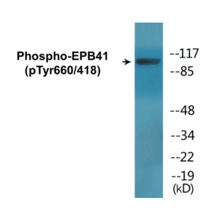 Western Blot - EPB41 (phospho Tyr660 + Tyr418) Cell Based ELISA Kit (CBP1819) - Antibodies.com