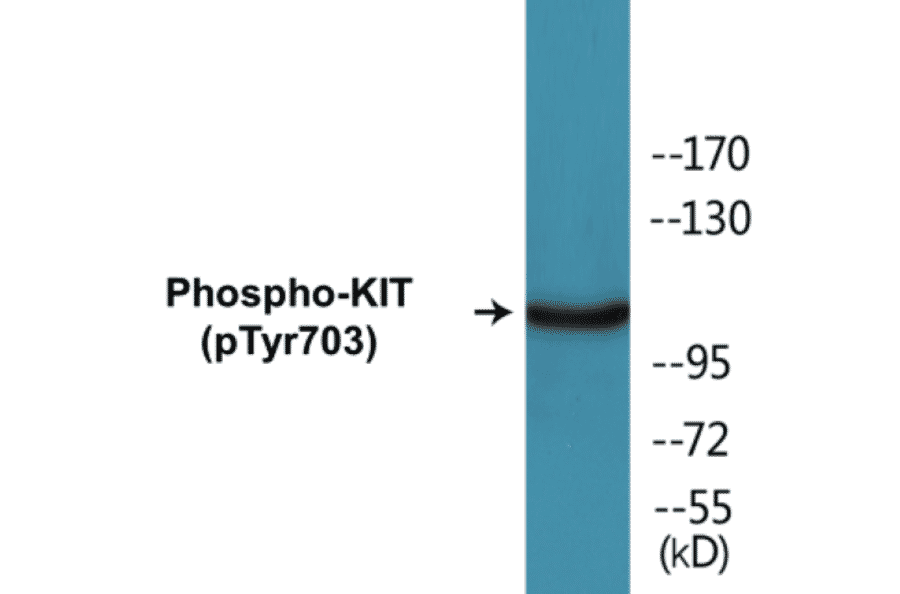 Western Blot - KIT (phospho Tyr703) Cell Based ELISA Kit (CBP1171) - Antibodies.com