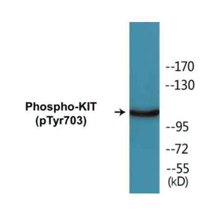 Western Blot - KIT (phospho Tyr703) Cell Based ELISA Kit (CBP1171) - Antibodies.com