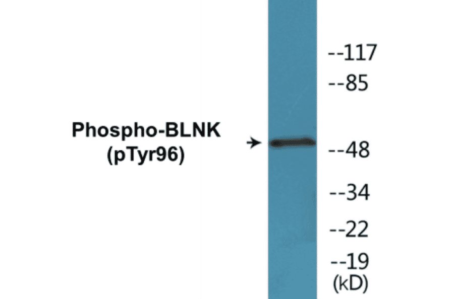 Western Blot - BLNK (phospho Tyr96) Cell Based ELISA Kit (CBP1244) - Antibodies.com