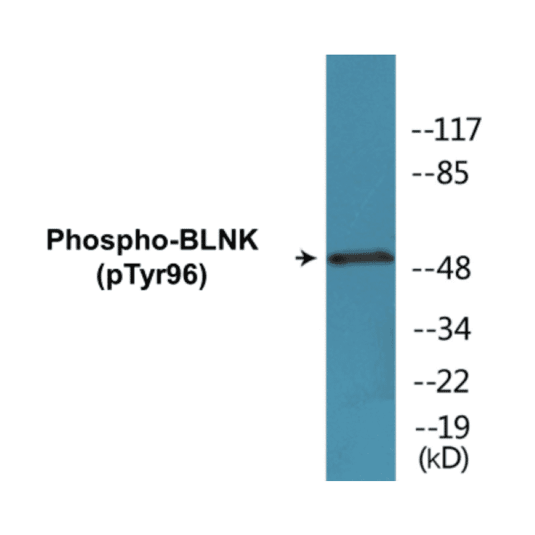 Western Blot - BLNK (phospho Tyr96) Cell Based ELISA Kit (CBP1244) - Antibodies.com