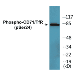 Western Blot - CD71 (phospho Ser24) Cell Based ELISA Kit (CBP1341) - Antibodies.com