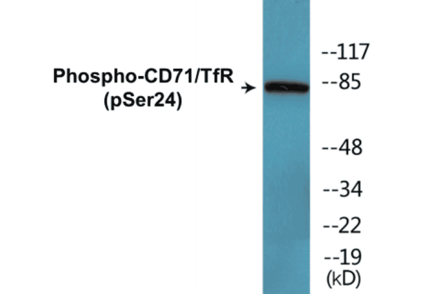 Western Blot - CD71 (phospho Ser24) Cell Based ELISA Kit (CBP1341) - Antibodies.com