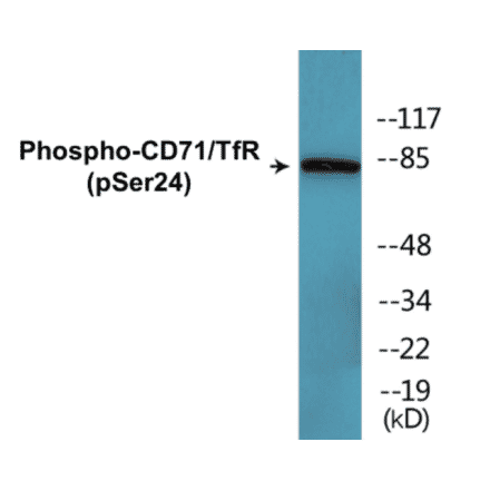 Western Blot - CD71 (phospho Ser24) Cell Based ELISA Kit (CBP1341) - Antibodies.com