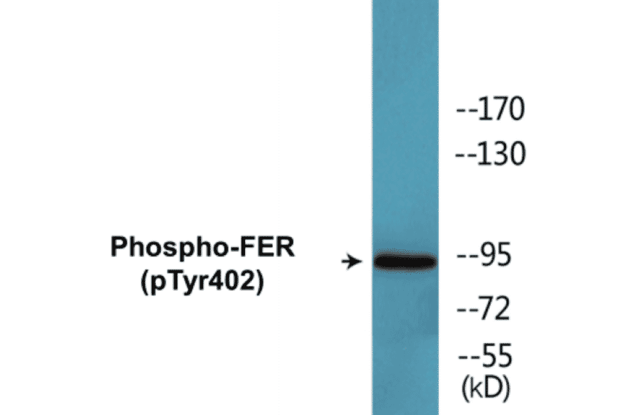 Western Blot - FER (phospho Tyr402) Cell Based ELISA Kit (CBP1742) - Antibodies.com