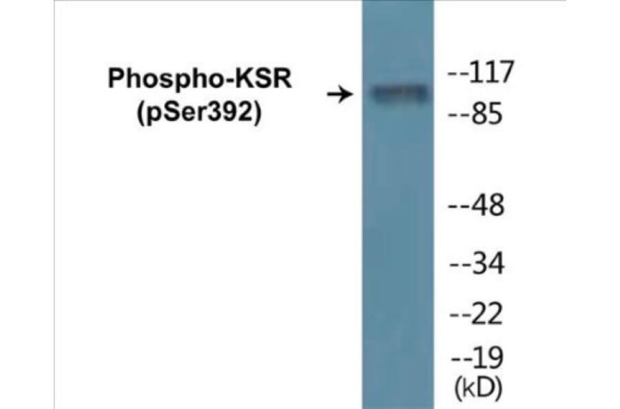 Western Blot - KSR (phospho Ser392) Cell Based ELISA Kit (CBP1068) - Antibodies.com