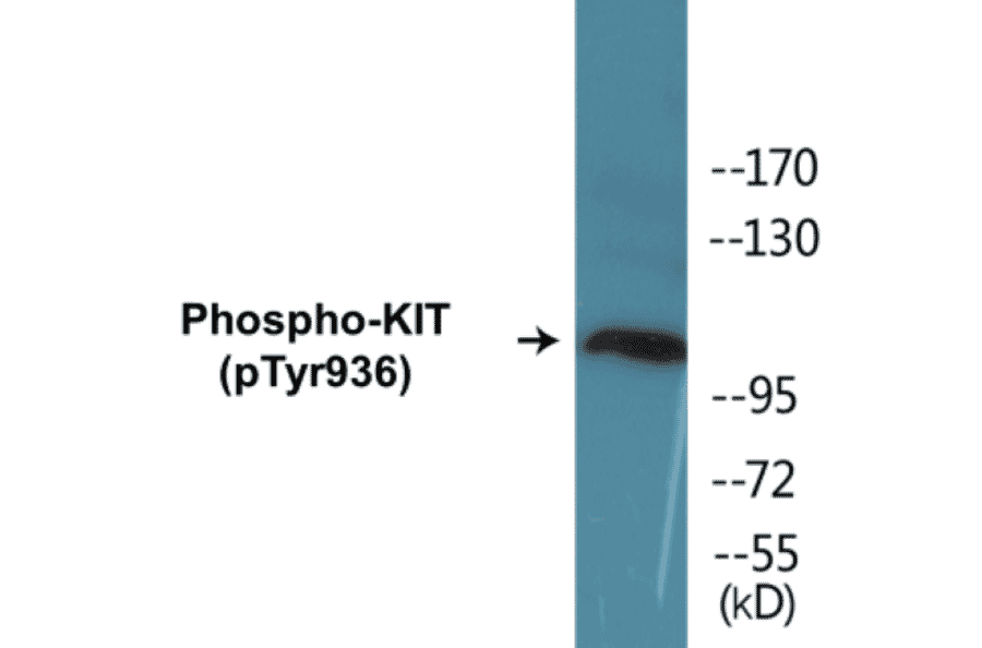 Western Blot - KIT (phospho Tyr936) Cell Based ELISA Kit (CBP1170) - Antibodies.com