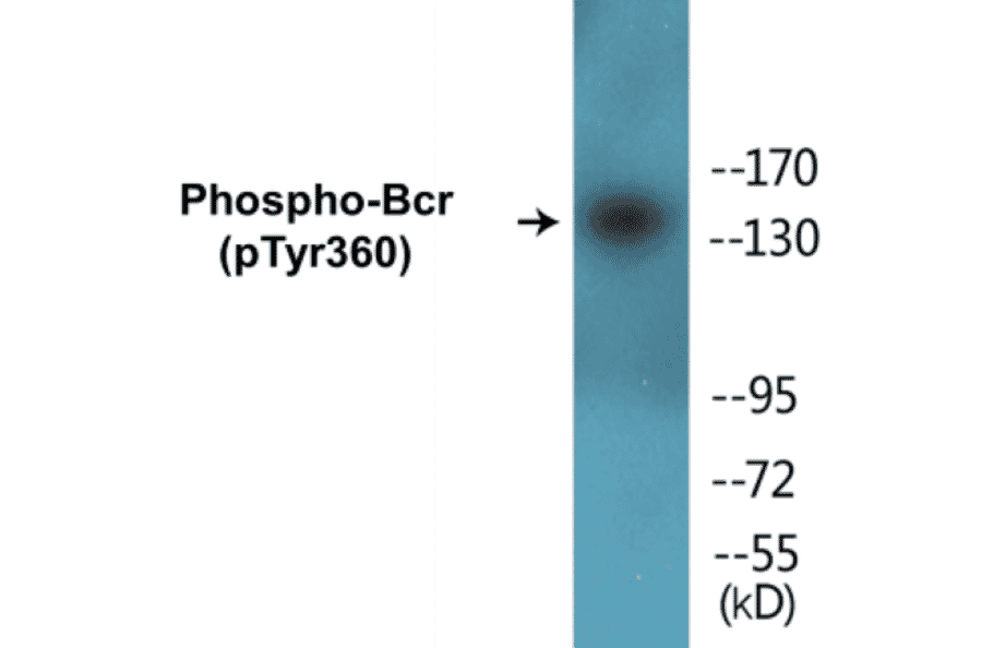 Western Blot - Bcr (phospho Tyr360) Cell Based ELISA Kit (CBP1296) - Antibodies.com