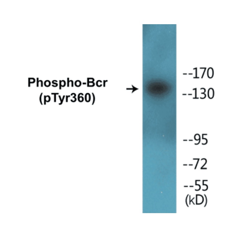 Western Blot - Bcr (phospho Tyr360) Cell Based ELISA Kit (CBP1296) - Antibodies.com