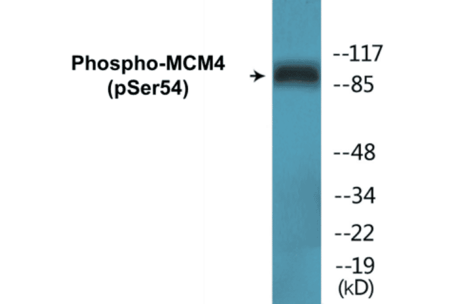 Western Blot - MCM4 (phospho Ser54) Cell Based ELISA Kit (CBP1363) - Antibodies.com