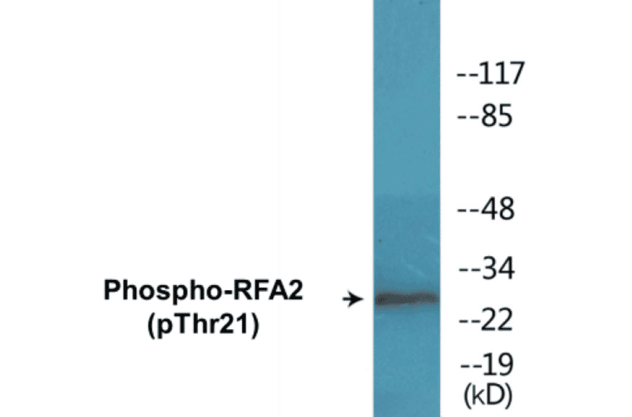 Western Blot - RFA2 (phospho Thr21) Cell Based ELISA Kit (CBP1390) - Antibodies.com