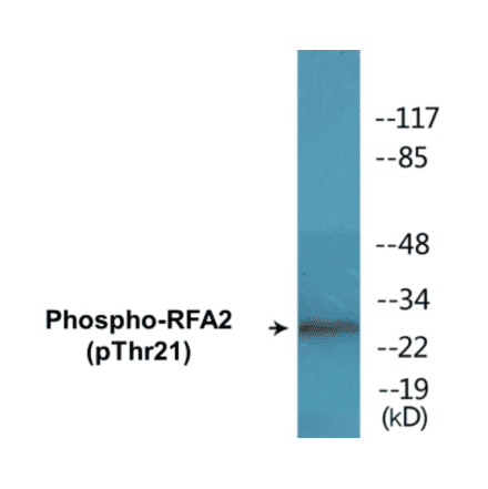 Western Blot - RFA2 (phospho Thr21) Cell Based ELISA Kit (CBP1390) - Antibodies.com