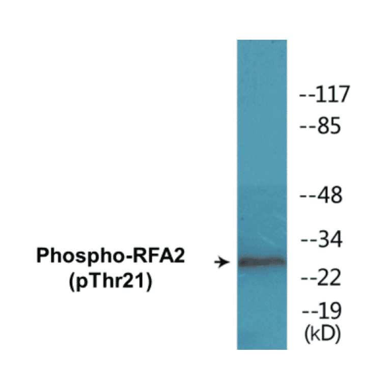 Western Blot - RFA2 (phospho Thr21) Cell Based ELISA Kit (CBP1390) - Antibodies.com