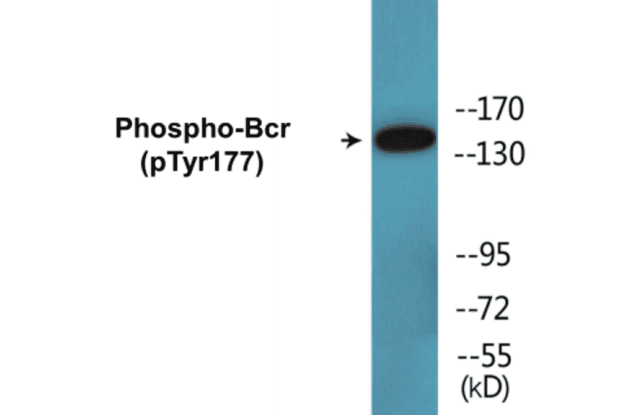 Western Blot - Bcr (phospho Tyr177) Cell Based ELISA Kit (CBP1508) - Antibodies.com