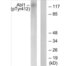 Western Blot - Abl (phospho Tyr412) Cell Based ELISA Kit (CBP1867) - Antibodies.com