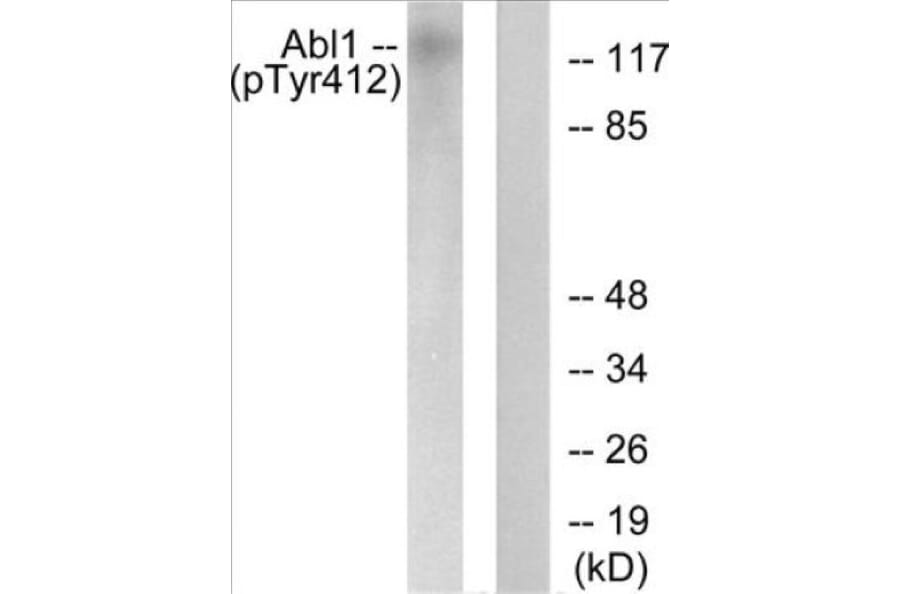 Western Blot - Abl (phospho Tyr412) Cell Based ELISA Kit (CBP1867) - Antibodies.com