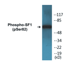 Western Blot - SF1 (phospho Ser82) Cell Based ELISA Kit (CBP1214) - Antibodies.com