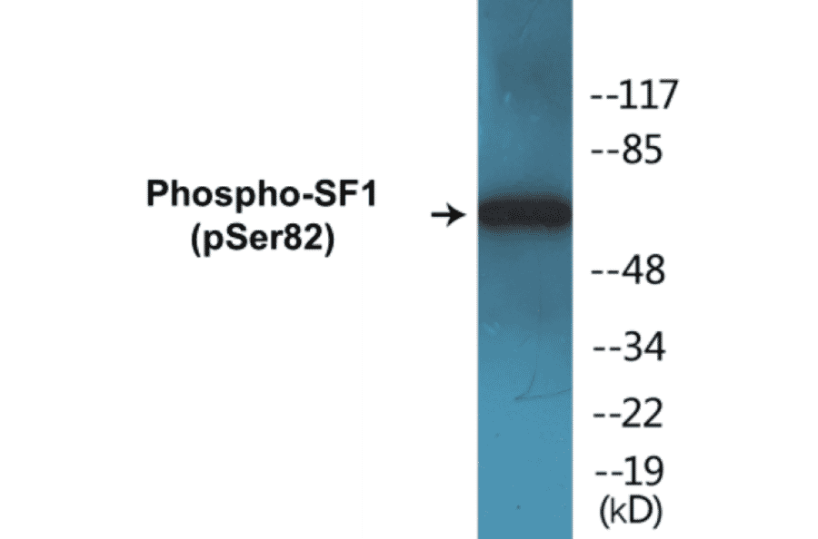 Western Blot - SF1 (phospho Ser82) Cell Based ELISA Kit (CBP1214) - Antibodies.com