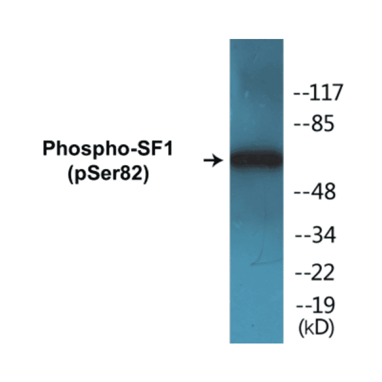 Western Blot - SF1 (phospho Ser82) Cell Based ELISA Kit (CBP1214) - Antibodies.com