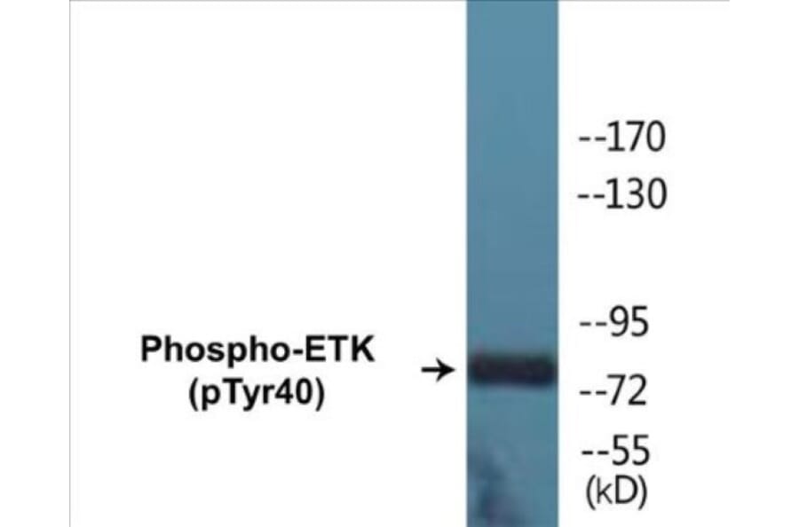 Western Blot - ETK (phospho Tyr40) Cell Based ELISA Kit (CBP1252) - Antibodies.com