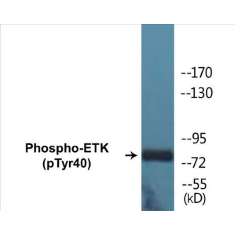 Western Blot - ETK (phospho Tyr40) Cell Based ELISA Kit (CBP1252) - Antibodies.com