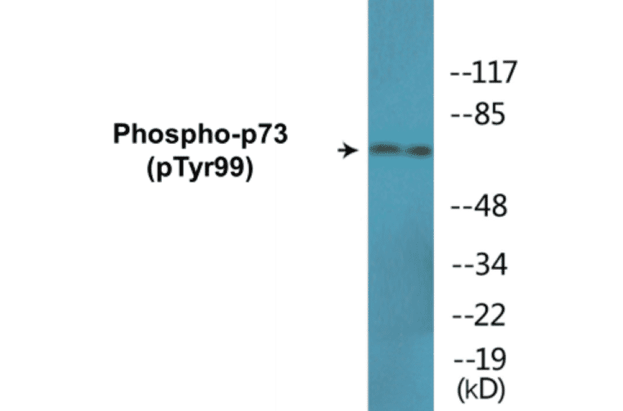 Western Blot - p73 (phospho Tyr99) Cell Based ELISA Kit (CBP1653) - Antibodies.com