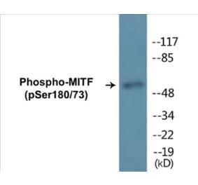 Western Blot - MITF (phospho Ser180 + Ser73) Cell Based ELISA Kit (CBP1179) - Antibodies.com