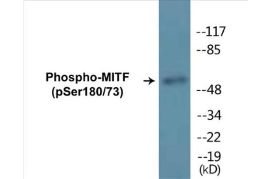 Western Blot - MITF (phospho Ser180 + Ser73) Cell Based ELISA Kit (CBP1179) - Antibodies.com