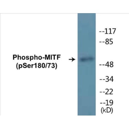 Western Blot - MITF (phospho Ser180 + Ser73) Cell Based ELISA Kit (CBP1179) - Antibodies.com