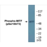 Western Blot - MITF (phospho Ser180 + Ser73) Cell Based ELISA Kit (CBP1179) - Antibodies.com