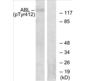Western Blot - Abl (phospho Tyr393 + Tyr412) Cell Based ELISA Kit (CBP1866) - Antibodies.com
