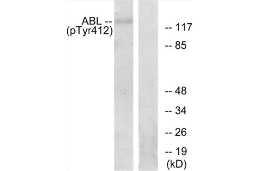 Western Blot - Abl (phospho Tyr393 + Tyr412) Cell Based ELISA Kit (CBP1866) - Antibodies.com