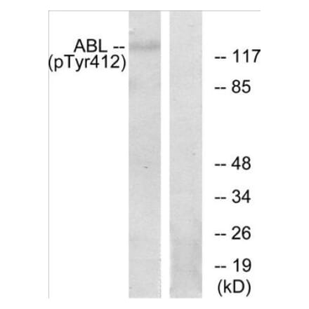 Western Blot - Abl (phospho Tyr393 + Tyr412) Cell Based ELISA Kit (CBP1866) - Antibodies.com