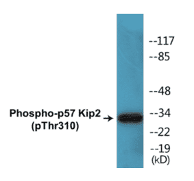 Western Blot - p57 Kip 2 (phospho Thr310) Cell Based ELISA Kit (CBP1386) - Antibodies.com