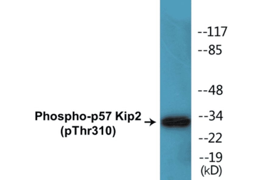 Western Blot - p57 Kip 2 (phospho Thr310) Cell Based ELISA Kit (CBP1386) - Antibodies.com