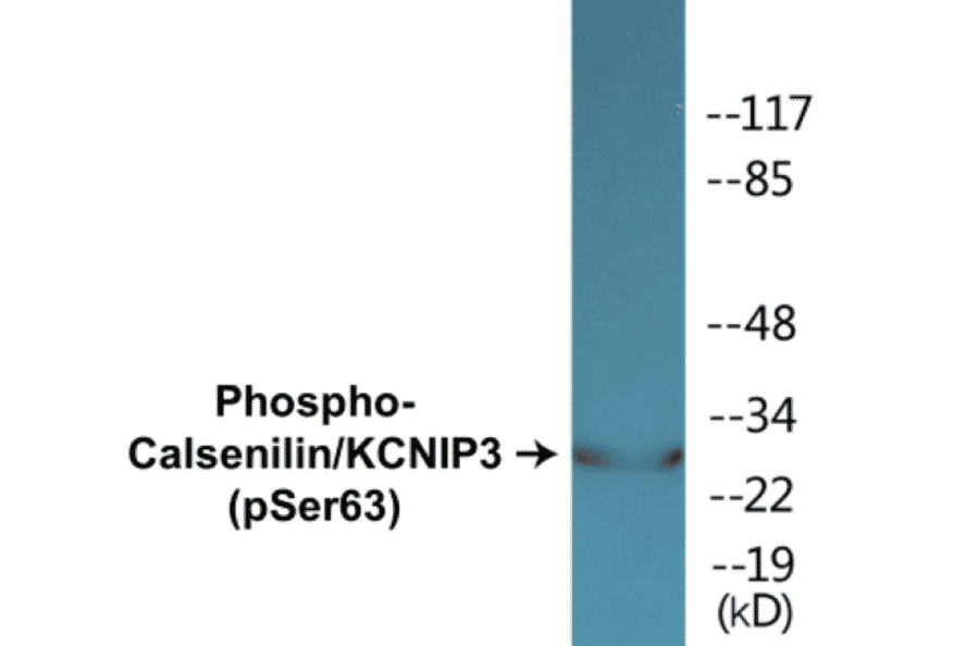 Western Blot - Calsenilin (phospho Ser63) Cell Based ELISA Kit (CBP1402) - Antibodies.com