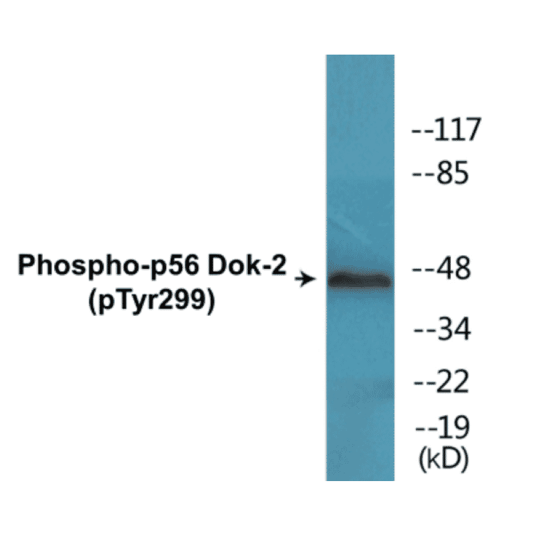 Western Blot - p56 Dok-2 (phospho Tyr299) Cell Based ELISA Kit (CBP1531) - Antibodies.com