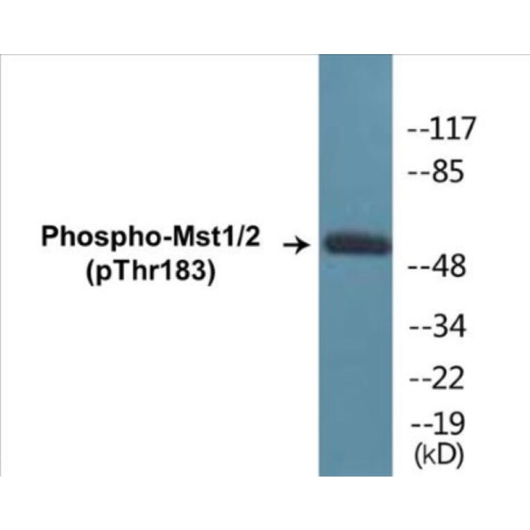 Western Blot - Mst1 + 2 (phospho Thr183) Cell Based ELISA Kit (CBP1262) - Antibodies.com