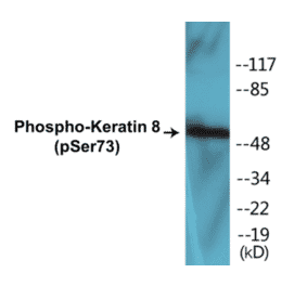 Western Blot - Keratin 8 (phospho Ser73) Cell Based ELISA Kit (CBP1017) - Antibodies.com