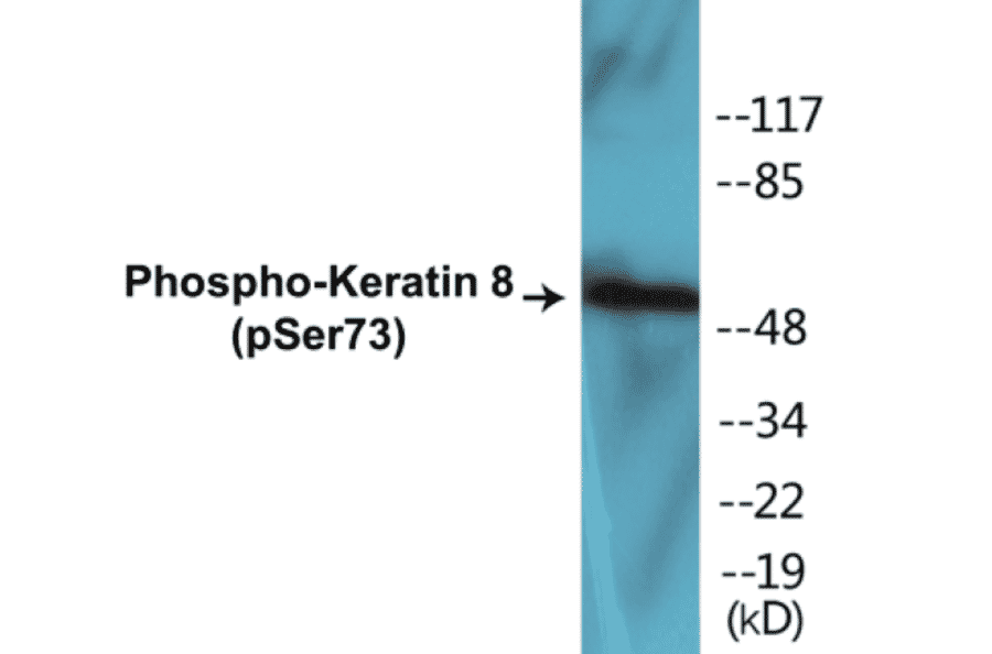 Western Blot - Keratin 8 (phospho Ser73) Cell Based ELISA Kit (CBP1017) - Antibodies.com