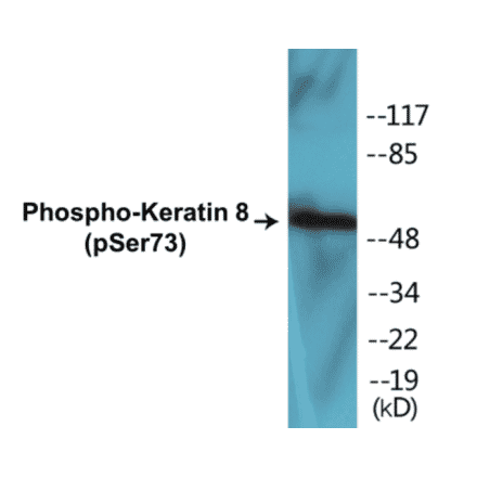 Western Blot - Keratin 8 (phospho Ser73) Cell Based ELISA Kit (CBP1017) - Antibodies.com