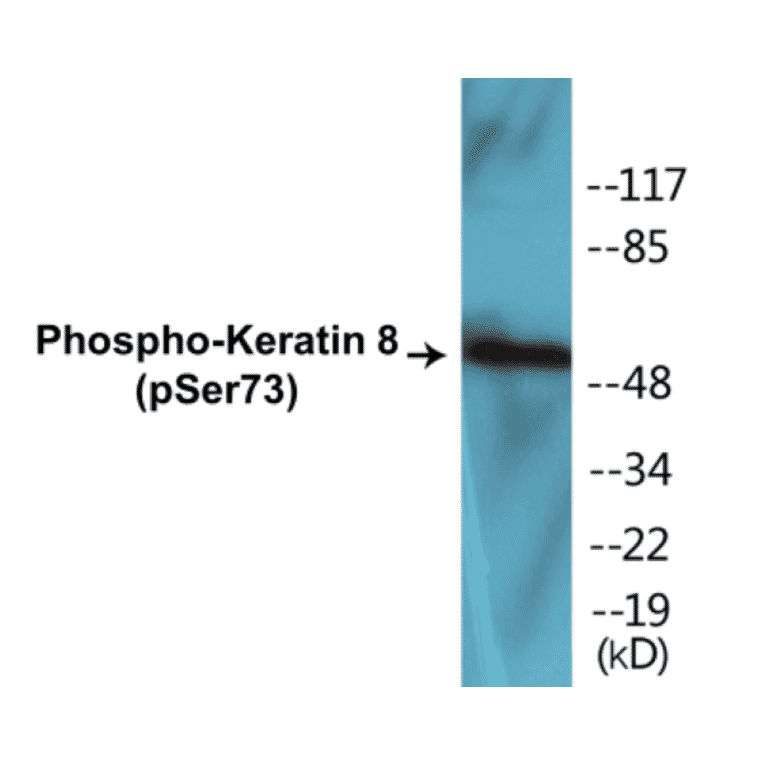 Western Blot - Keratin 8 (phospho Ser73) Cell Based ELISA Kit (CBP1017) - Antibodies.com