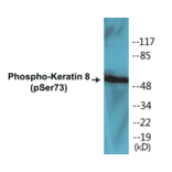 Western Blot - Keratin 8 (phospho Ser73) Cell Based ELISA Kit (CBP1017) - Antibodies.com